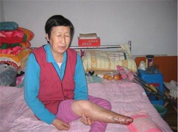 Image for article Une femme âgée de 72 ans, qui a perdu son pied droit à la suite d’injections toxiques en détention, fait face à de nouvelles poursuites pour sa croyance (photos)