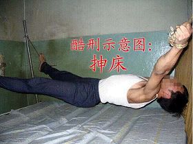 Image for article Les autorités torturent un homme, lui cassant une jambe et  refusent ensuite de le laisser rencontrer son avocat