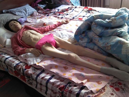 Image for article Torturées dans la prison pour femmes du Liaoning, des pratiquantes de Falun Gong sont dans un état critique : l'une meurt après cinq ans d'alitement (voir photo)